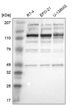 Acinus Antibody, Novus Biologicals 0.1mL; Unlabeled:Antibodies, Polyclonal